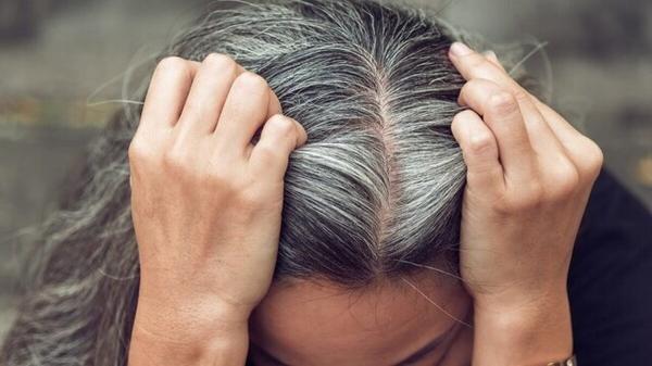 آیا استرس واقعا عامل سفیدشدن مو است؟ آیا استرس واقعا عامل سفیدشدن مو است؟